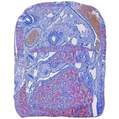 Histology Inc Histo Logistics Incorporated Human Liver Rhodanine Stain Copper Full Print Backpack by Mariart